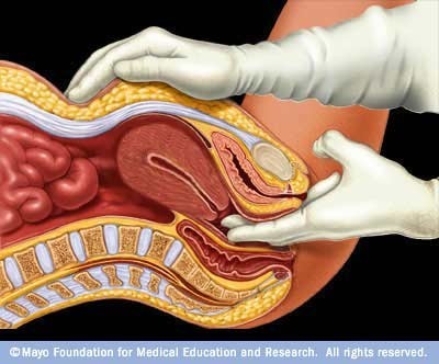 diagram of a pelvic exam