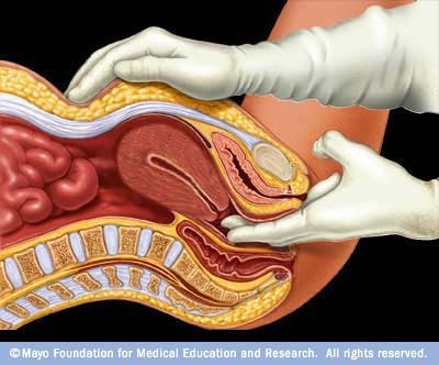 diagram of a pelvic exam